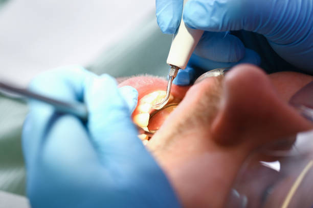 Best Dentist for Dental Trauma  in Pierson, FL